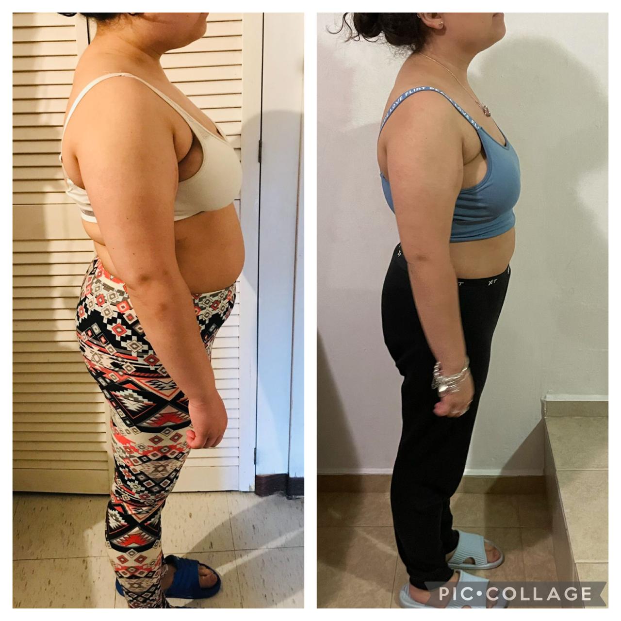 Resultado de paciente antes y después de su plan nutricional